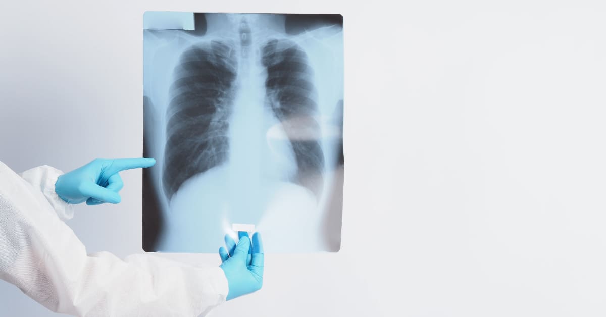 Cirurgiã torácica exibindo radiografia de tórax humano